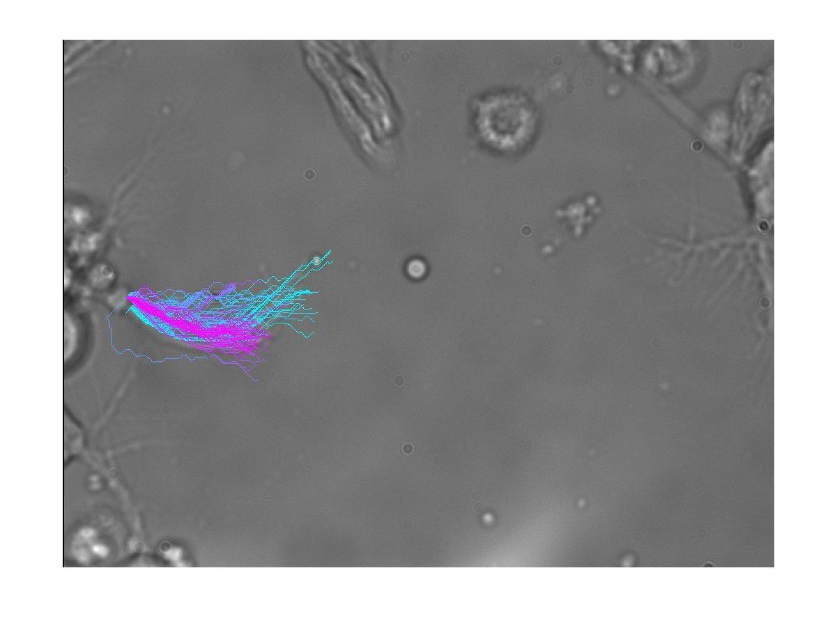 Tracked neuron growth-cone trajectories in a bright-field microscopy image